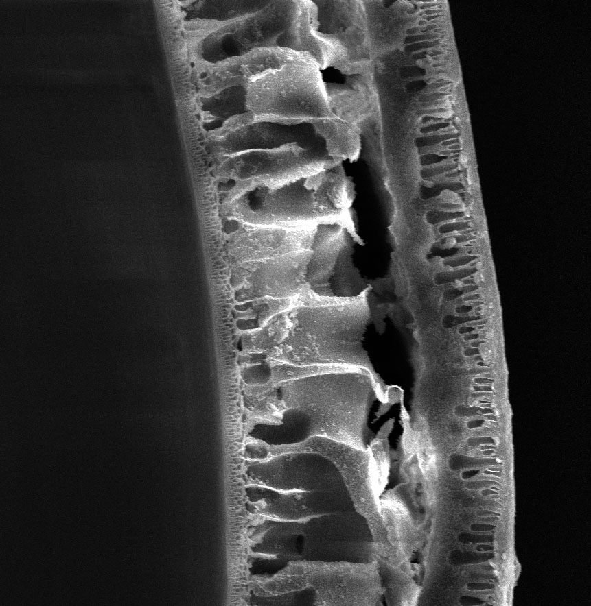 Scanning electron microscope cross-section of a UF hollow-fiber membrane wall